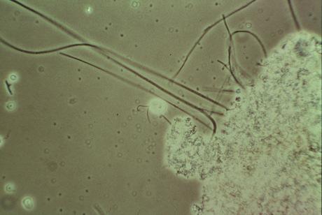 A significant increase in the number of these bacteria results in a white, "furlike" coating.