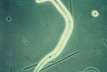 The free oxygen content is 4 to 6 mg per liter, which means sufficient aeration. Optimal conditions are indicated by the presence of certain ciliate protozoan: Chilodonella (Fig.