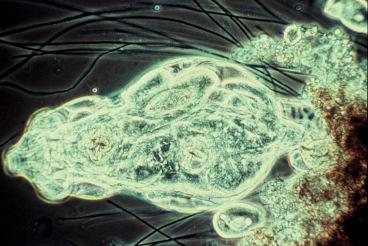 Chilodonella (magnified 400 times) Figure 8. Epistilis sp. (magnified 100 times) Oligosaprobic water is poor in nutrition, and the decomposition of organic matter is at a low level.