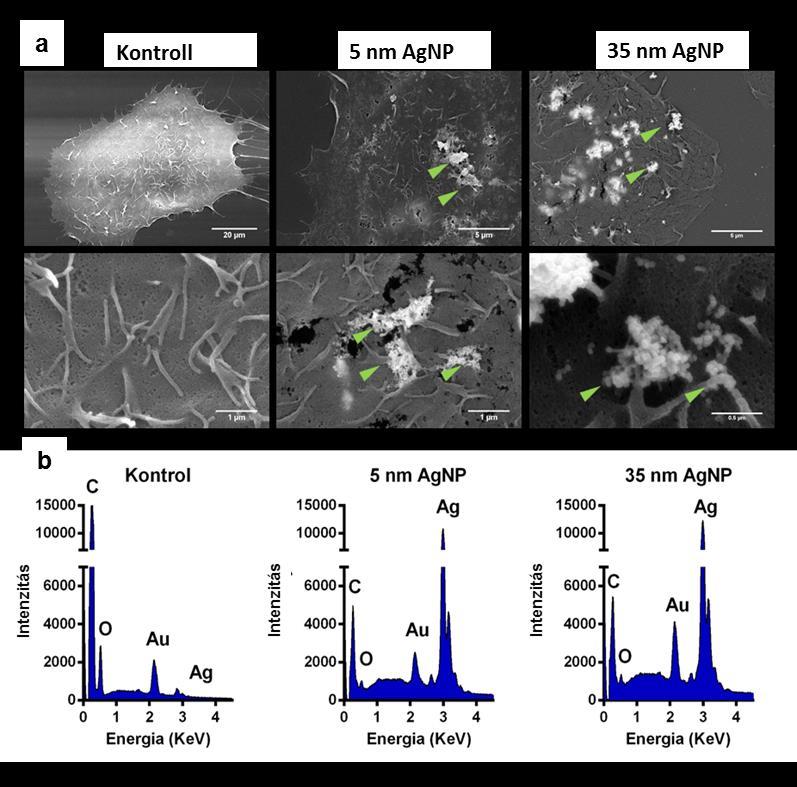 5. ábra. Az ezüst nanorészecskék megtapadnak az oszteoszarkóma sejtek plazmamembránján.