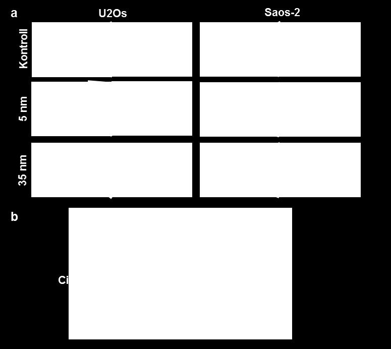 (a) 5 illetve 35 nm átmérőjű ezüst nanorészecskékkel történő kezelések hatására megváltozik a U2Os és Saos-2 sejtek mitokondriumainak ultrastruktúrája.