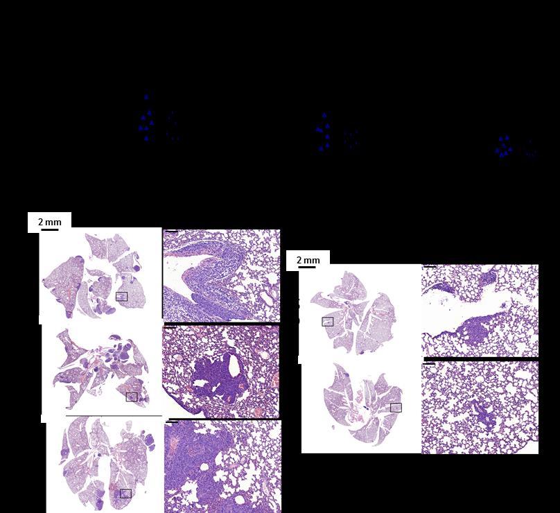 25. ábra. Az arany-ezüst hibrid nanorészecske kezelések in vivo gátolják a 4T1 tumorok áttétképződését. A kísérlet végén ex vivo vizsgáltuk az állatok tüdejét.