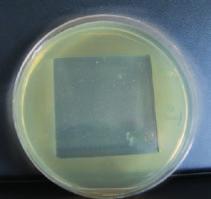 Baktériumok Staphylococcus Aureus Escherichia Coli Pseudomonas Aeruginosa 2.