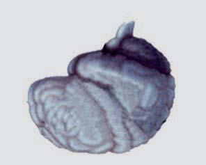 Stress mediators: role of the brain - McEwen Dialogues in Clinical Neuroscience - Vol 8. No. 4.