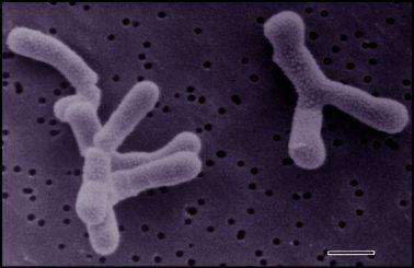 Tejsav baktériumok Lactococus (régebben Sterptococcus) lactis leggyakoribb: aludttej Lactobacillus fajok L.