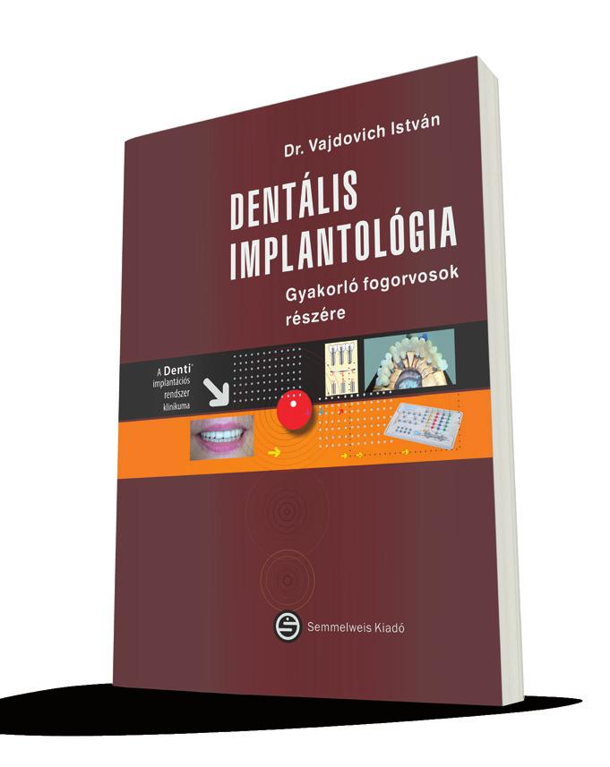 IMPLANTOLÓGIA