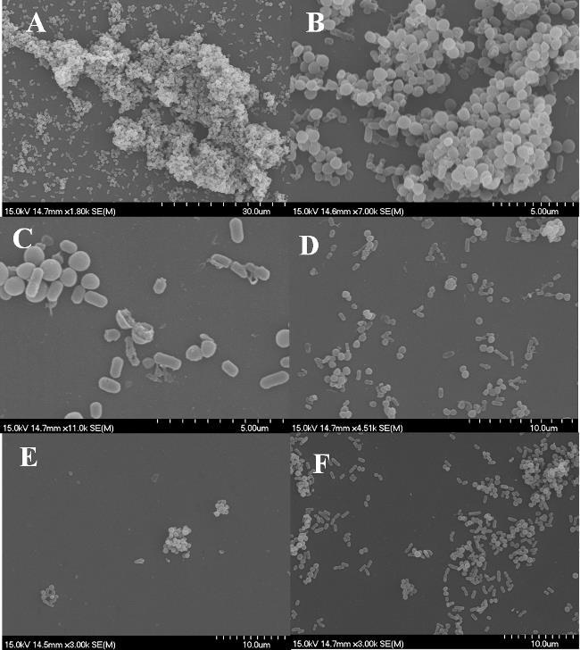 Kevert biofilmek SEM vizsgálata L. monocytogenes + S. aureus 19. ábra. L. monocytogenes and S. aureus kevert biofilmek SEM felvétele.