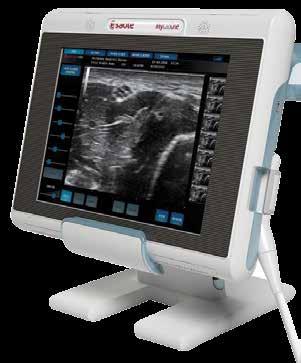 részére) SL3116 4-9 MHz / 6-10 MHz up to 93o 186 mm Anaesthesiology, Pediatrics, Vascular Micro-convex Array 10-22 MHz 20x 40 mm
