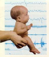 Az irányelv segítségével a következők javíthatók: a fejlődésneurológiai diagnosztika és a neuroterápia eredményessége, megfelelősége, biztonságossága és költséghatékonysága. (1. TÁBLÁZAT). 1.