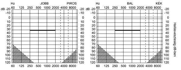 Audiogram