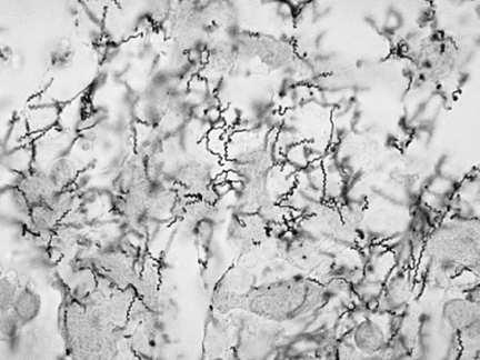Általános jellemzés Spirochaeták Treponema Borrelia Leptospira Vékony, hosszú, helikális baktériumok 0,1-0,5 x 5-30 µm Gram festéssel nem festődnek Kimutatásuk: speciális módszerekkel Natív