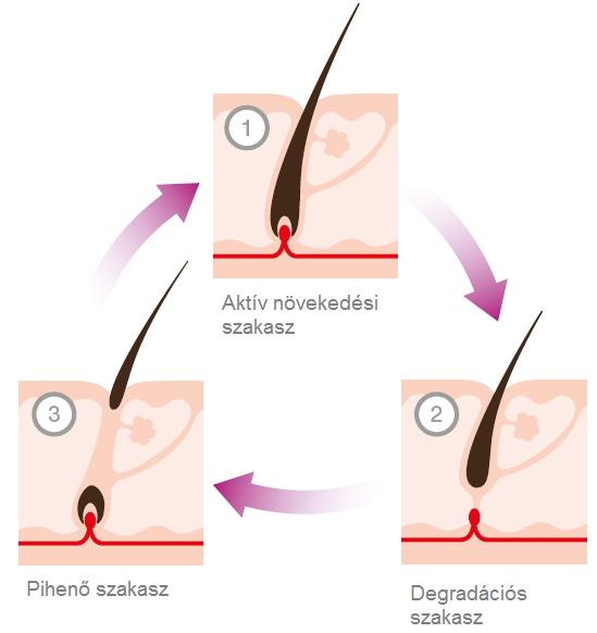 Az IPL kezelés az aktív szőrnövekedési szakaszban a leghatékonyabb.