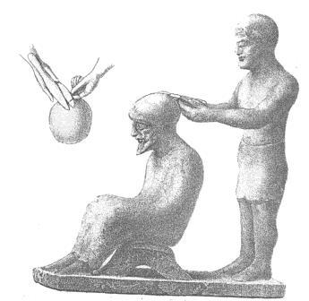 egymáshoz erősítve. A római Loculus-táblák egyikén csupán valamiféle zsinór köti össze a pengéket. 151 1.