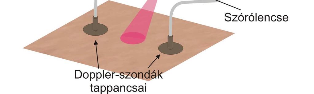 Sajnos a rendelkezésre álló eszközök és alkatrészek (a véges hosszú fel- és lefutási idők miatt) csak erősen korlátozott számú felvillanást tesznek lehetővé.