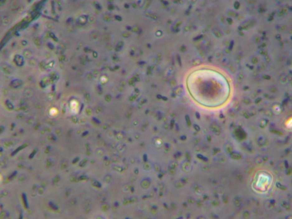 GIARDIA -