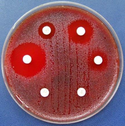 baromfitartásban használatos fluorokinolon összefüggésbe hozható a humán fluorokinolon rezisztens Campylobacter fertőzésekkel (Skarp és mtsai, 2016). Néhány baktérium (pl.