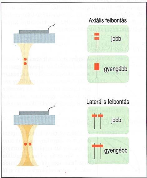 1. Technikai-metodika alapok 1.1. Fizikai-technikai alapok más mélységben kell a fokozott felbontás és így a nyaláb fókuszálása: transzducert kell cserélni.