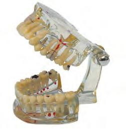 oldal) 135 202 Bemutató modell (implantátum, K+B) 1 db 54.
