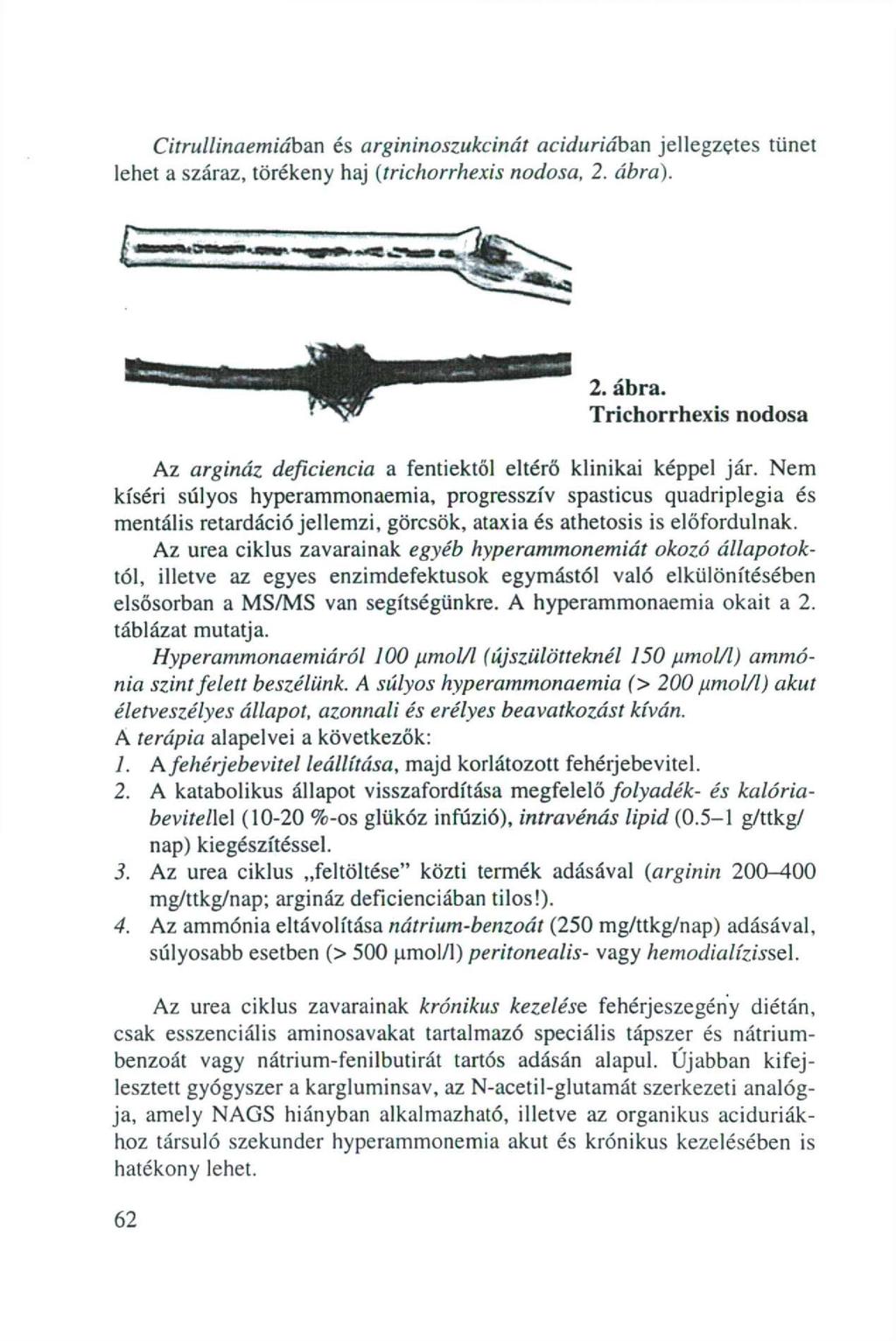 Citrullinaemiában és argininszukcinát aciduriábm jellegzetes tünet lehet a száraz, törékeny haj (trichrrhexis ndsa, 2. ábra)