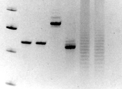 Multiplex PCR Klonalitás meghatározása