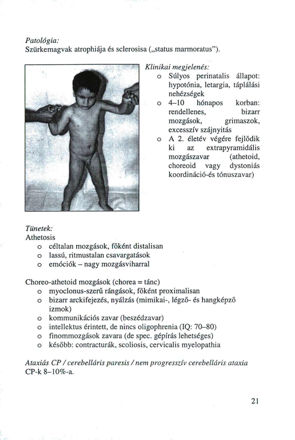 Patlógia: Szürkemagvak atrphiája és sclersisa ( status marmratus").
