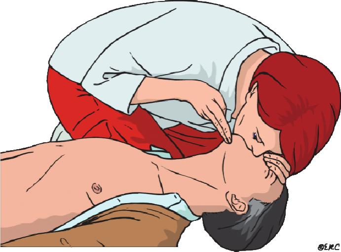 Személy- és vagyonvédelem A légzés akadályát megszüntetve előfordulhat, hogy spontán rendeződik a beteg légzése, vagy az eddig hallható szörcsögő, sípoló, hörgő légzési hang kitisztul.