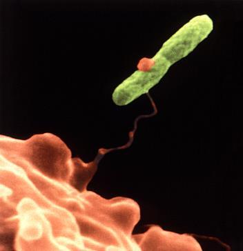 A Legionella jelenlétének (köz)egészségügyi kockázata, emberi érintettség Szaporodási feltételek mesterséges környezetekben Vizes környezet, tápanyag, megfelelő hőmérséklet.