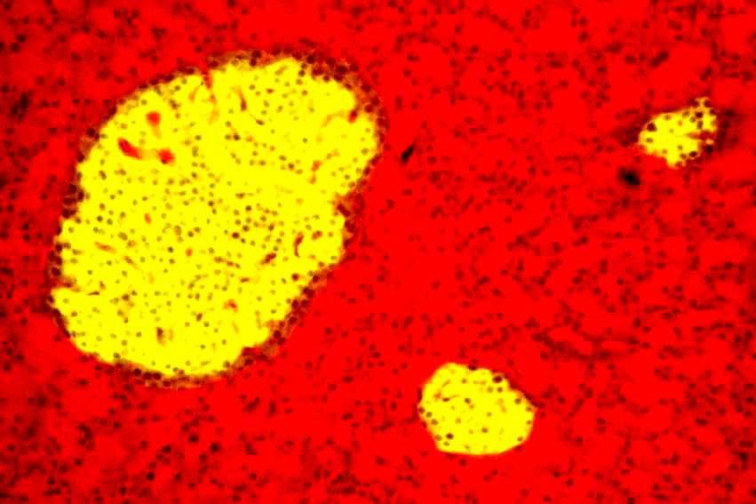 A Langerhans sziget 200 µm ~ 3,000 sejt 75% béta-sejt