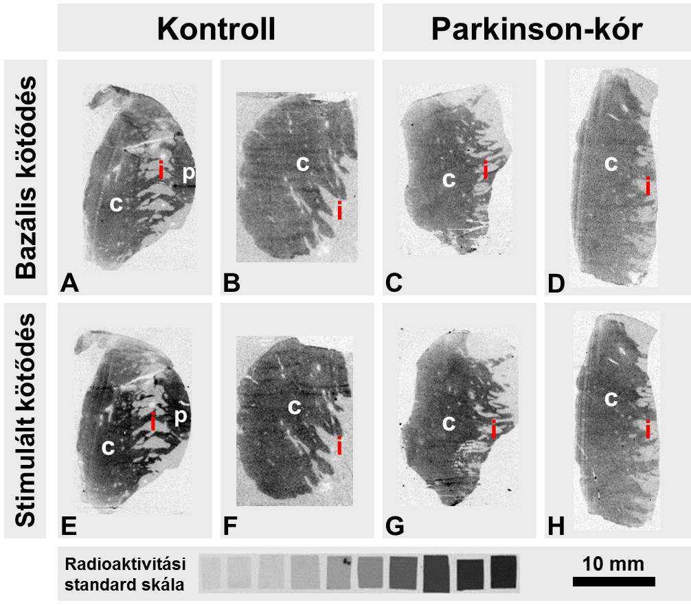 6. ábra. Dopamin által stimulált receptor [ 35 S]GTPγS kötődési autoradiográfia emberi nucleus caudatus (c) mintákon, [ 14 C] radioaktivitási standard skálával.