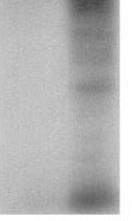 elegyével (DPV) (bal oldal 15 perc, jobb oldal 0-60 perc) kezelt konfluens BPAEC-ből készült sejtlizátumok urea gélelektroforézis utáni immunoblotja MLC elleni antitesttel, n= 3.