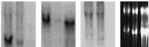 4.1.2.1.1 Protein foszfatáz 1 katalitikus alegység az endotél sejtekben HUVEC-ből izolált totál RNS mintából RT-PCR-ral ~230 bp méretű DNS
