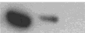 (A) HUVEC, BPAEC és humán uterus simaizom RNS Northern blot vizsgálata. 20µg totál RNS-t 1%-os agaróz gélen választottunk el.