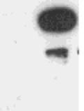(B) Miozinban gazdag BPAEC frakció Western blot vizsgálata PP1c α és β izoformára specifikus antitestekkel.