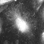 A PP1 PP2A PP2B Ac Tu Cy Vi B Tubulin Tau PP2A HSP27 4.1.19 ábra Ser/Thr specifikus protein foszfatázok az EC szubcelluláris frakcióiban.