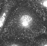 intermedier filamentumokban/vimentin, Vi gazdag) fehérjéit 10%-os SDS-PAGE-sel elválasztottuk, és nitrocellulóz membránra blottoltuk.