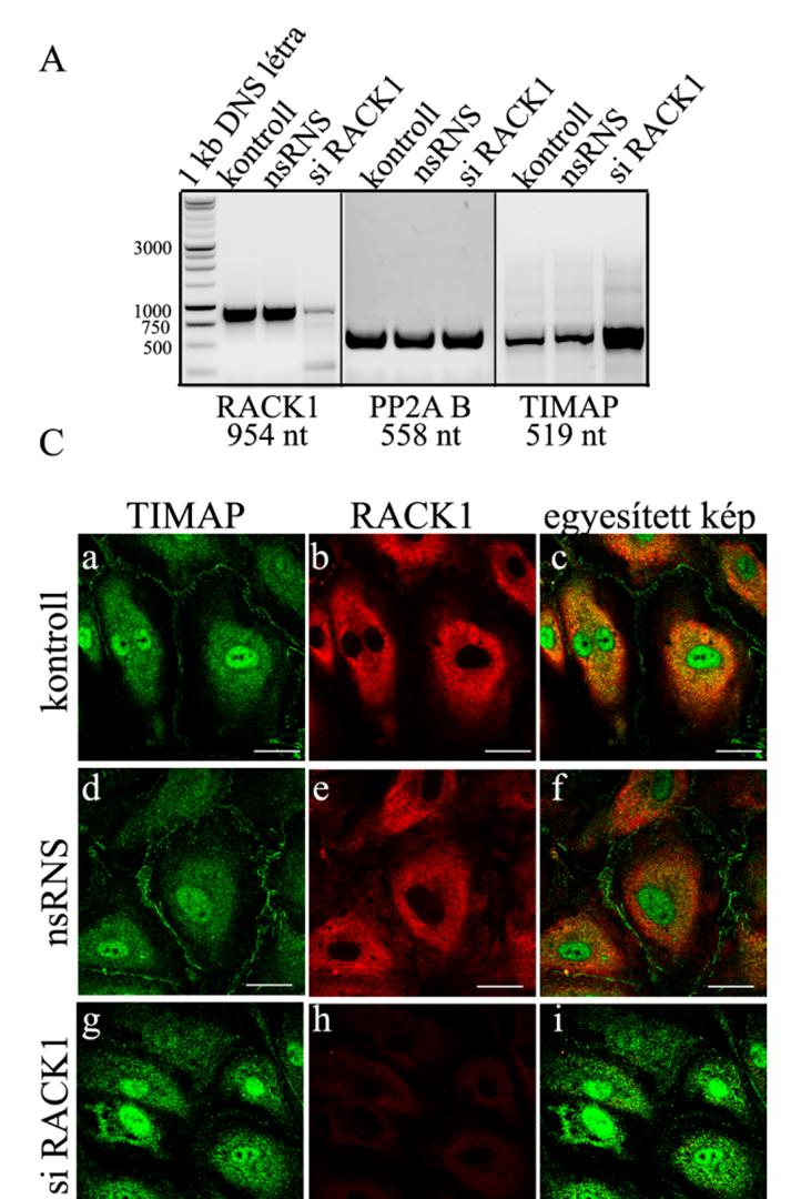 A RACK1 fehérjét eredményesen csendesítettük HPAEC-ben sirns transzfekcióval. RT-PCR-ral mrns szinten 70-80%, Western blottal fehérje szinten ~50% csökkenést detektáltunk (4.2.5 ábra, A-B).