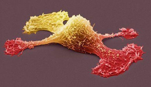 III. A sejtváz szerveződése megváltozik - megnő a sejtmotilitás Megváltozott sejt-sejt és