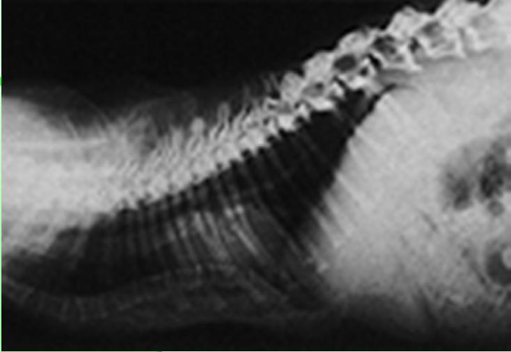 Mukopoliszacharidózis (VI. típus, Sziámi és Ragdoll macska) http://cal.vet.upenn.edu/projects/saortho/chapter_57/57mast.