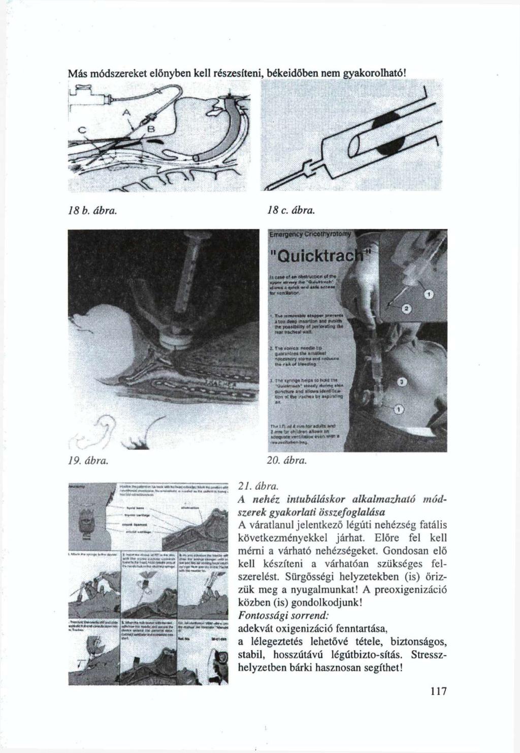 Más módszereket előnyben kell részesíteni, békeidőben nem gyakorolható! 18 b. ábra. 18 c. ábra. Emsrgeiií y Crvceieyroioi "Quicktrac, 11 ;j.