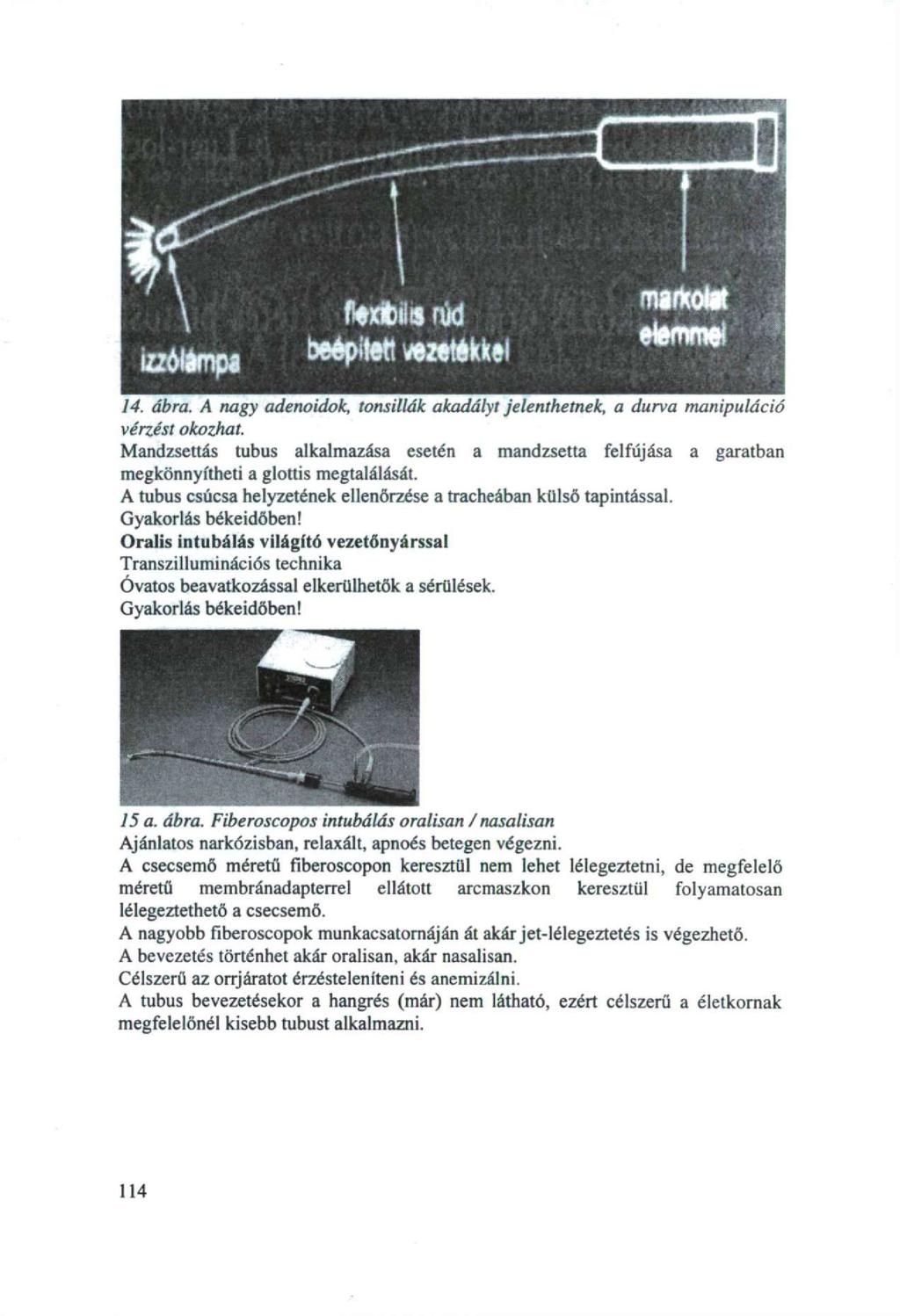 14. ábra. A nagy adenoidok, tonsillák akadályt jelenthetnek, a durva manipuláció vérzést okozhat.