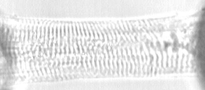 A 40 µm 10 kn/m 2 10 s Kontroll 2,5 mm DTDP 10 mm DTDP 10 mm DTDP+ 10 mm DTT B 20 kn/m 2 10 s Kontroll 10 mm DTT 11. ábra.