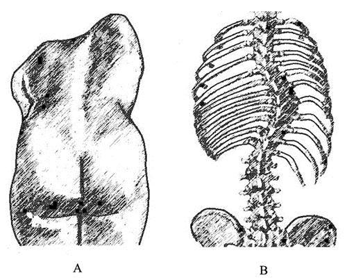 Mozgásrendszerek b./ Bordák (costae) Abroncs alakú, lapjukra hajlított és csavart lapos csontok. 12 pár bordánk van. A bordák részei (5.13.