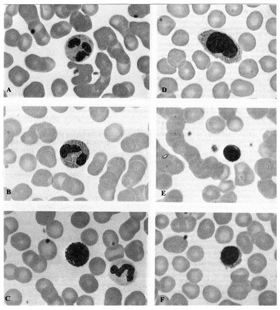 Alapszövetek vérszegénységben és vashiányos állapotban figyelhető meg. A vörösvértestek mérete kb. 7 μm. A sejtek rendkívül rugalmasak, ezért a szűk átmérőjű kapillárisokon is áthaladnak.