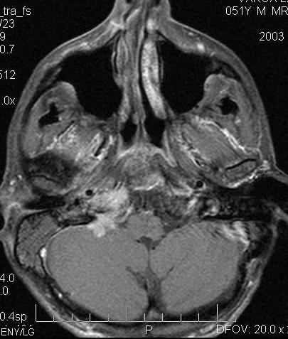 MR/CT/US
