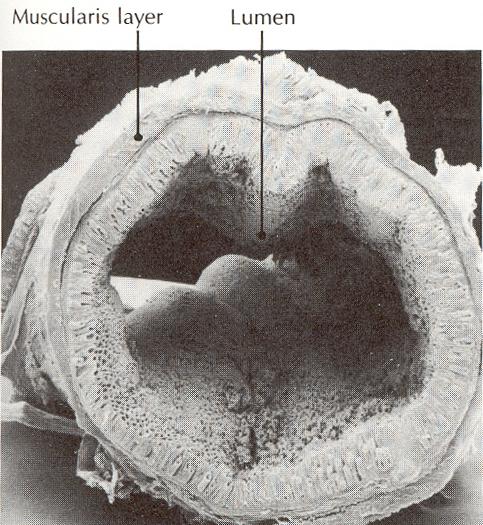 VASTAGBÉL DAGANATOK DIAGNOSZTIKAI MÓDSZEREI Laborok Endoscopia