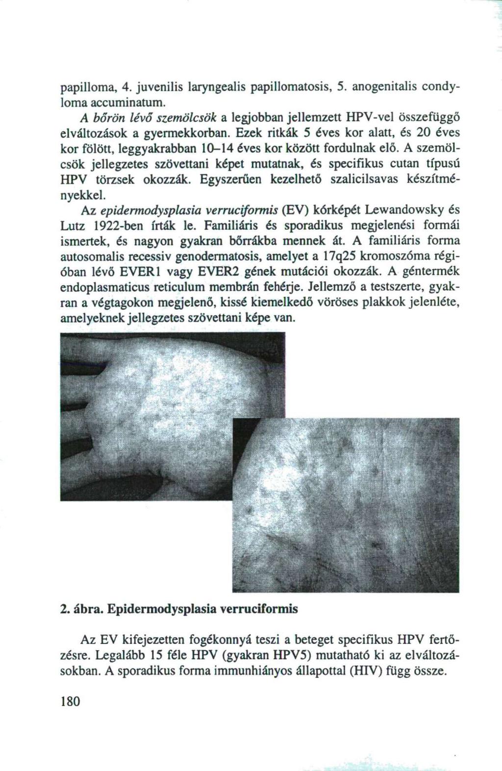 papilloma, 4. juvenilis laryngealis papillomatosis, 5. anogenitalis condyloma accuminatum. A bőrön lévő szemölcsök a legjobban jellemzett HPV-vel összefüggő elváltozások a gyermekkorban.
