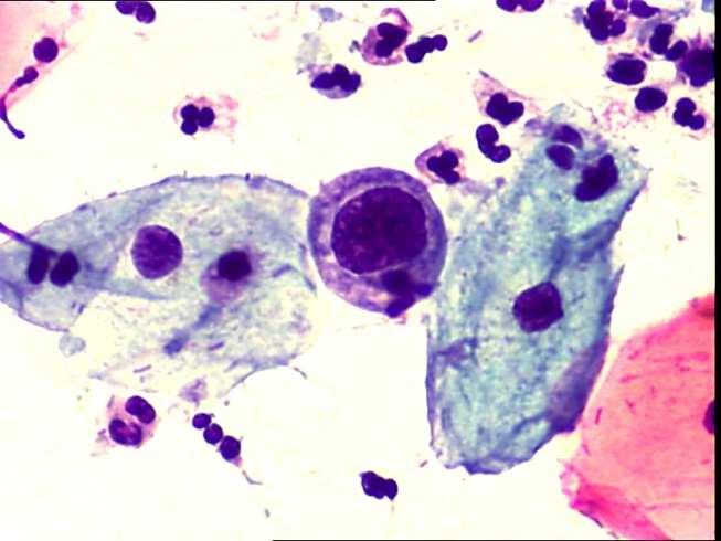 konvencionális cervix