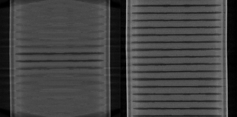 Helical, csigavonalas CT (Spirál CT) Alapelvek: Mindkét fogatás és függőleges mozgások egyidejű végrehajtása Együtt csigavonalas hatás Előnyök: Kerülni kell a gyűrűs képeket
