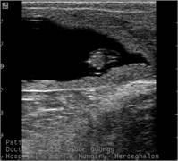 Ultrahangos vemhességvizsgálat Nagy biztonsággal a vemhesítés utáni 28-30. napon végezhető el.