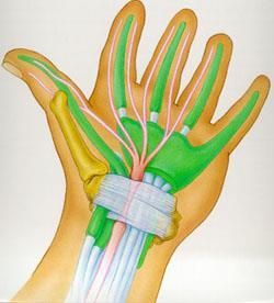 Carpalis alagút szindróma Hüvelyk-mutató-középső ujj zsibbadás (a zsibbadás a